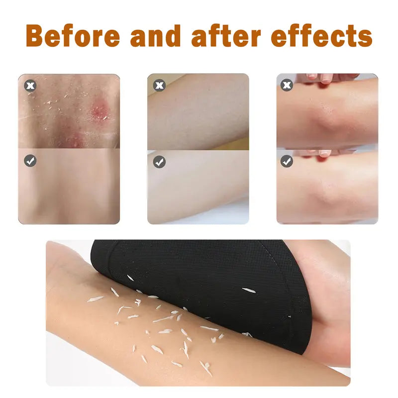Soft Silicone Shower Scrubber – Gentle Exfoliating Body Brush (4-Pack)