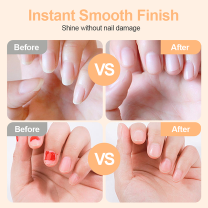 💗LAST DAY SALE 49% OFF⚡50K+ SOLD💕🌟2-in-1 Safe Electric Nail Clipper