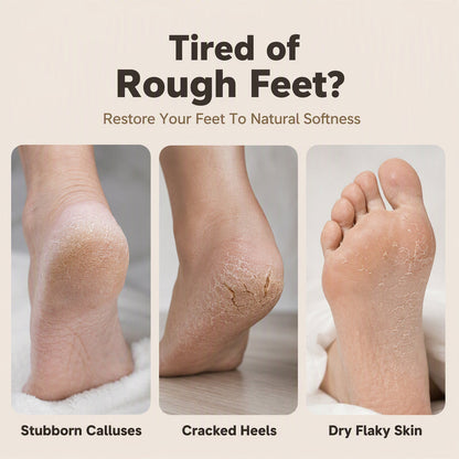 Multifunctional Electric Foot Callus Remover