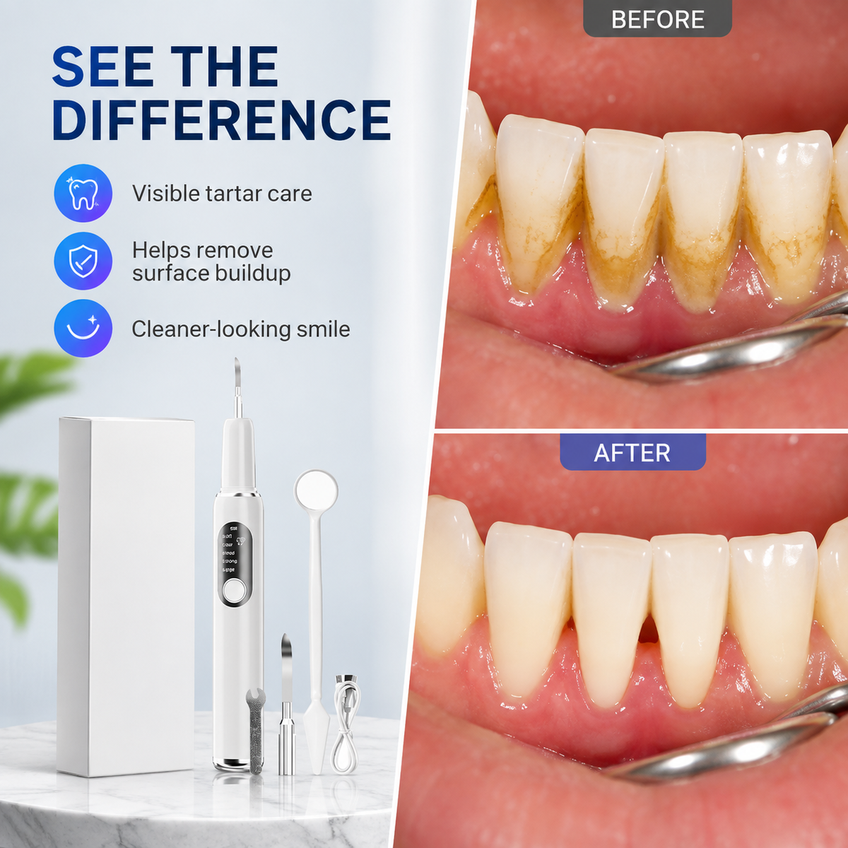 🦷 T6 Smart Ultrasonic Teeth Cleaner – 5 Modes, Touch-Activated Cleaning & Complete Tool Kit