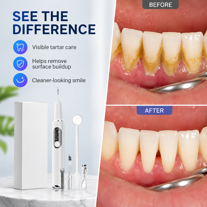 🦷 T6 Smart Ultrasonic Teeth Cleaner – 5 Modes, Touch-Activated Cleaning & Complete Tool Kit